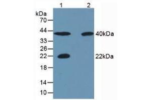 Western blot analysis of (1) Porcine Skeletal Muscle Tissue, (2) Rat Skeletal Muscle Tissue, (3) Human Liver Tissue and (4) Human Lung Tissue. (CA3 Antikörper  (AA 2-260))