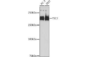 Western blot analysis of extracts of various cell lines, using TSC2 antibody (ABIN7271027) at 1:1000 dilution. (Tuberin Antikörper)