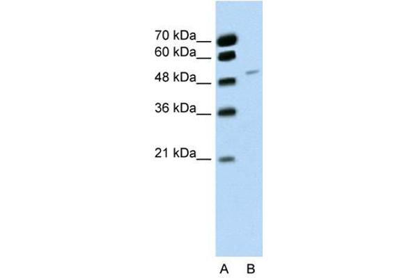 RBM22 Antikörper  (C-Term)