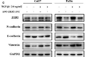 Western Blotting (WB) image for anti-Vimentin (VIM) antibody (ABIN2854814)