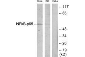 Western blot analysis of extracts from HeLa/293 cells, using NF-kappaB p65 (Ab-468) Antibody. (NF-kB p65 Antikörper  (AA 435-484))