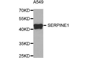 Western Blotting (WB) image for anti-Plasminogen Activator Inhibitor 1 (SERPINE1) antibody (ABIN1882338) (PAI1 Antikörper)