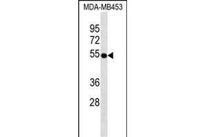 VDR Antibody ABIN1539943 western blot analysis in MDA-M cell line lysates (35 μg/lane). (Vitamin D Receptor Antikörper)