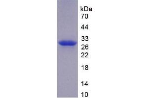 SDS-PAGE analysis of recombinant Mouse F11 Protein. (Factor XI Protein)