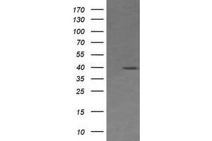 Image no. 1 for anti-Mitogen-Activated Protein Kinase Kinase 3 (MAP2K3) antibody (ABIN1499408) (MAP2K3 Antikörper)