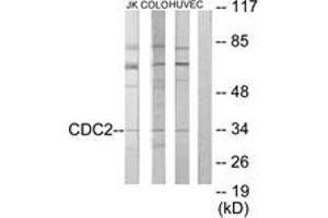 Western blot analysis of extracts from COLO205/HuvEc/Jurkat cells, using CDC2 Antibody. (CDK1 Antikörper  (AA 101-150))