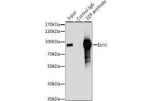Immunoprecipitation analysis of 200 μg extracts of 293T cells, using 3 μg Ezrinin antibody (ABIN6129377, ABIN6140400, ABIN6140401 and ABIN6213959). (Ezrin Antikörper  (AA 350-470))