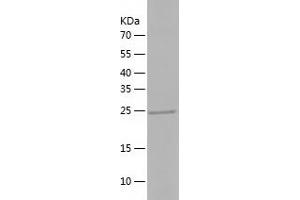 Western Blotting (WB) image for Phosphatase, Orphan 2 (PHOSPHO2) (AA 1-241) protein (His tag) (ABIN7124395) (PHOSPHO2 Protein (AA 1-241) (His tag))