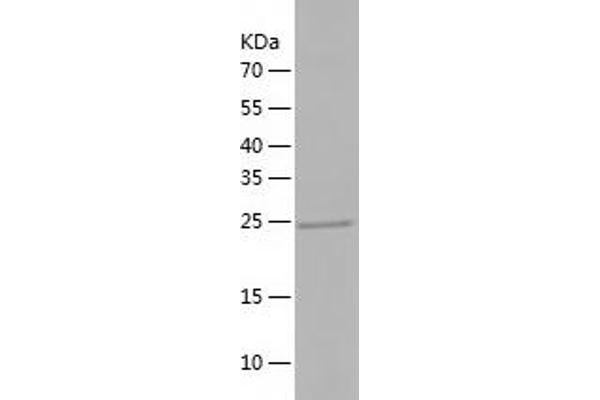 PHOSPHO2 Protein (AA 1-241) (His tag)