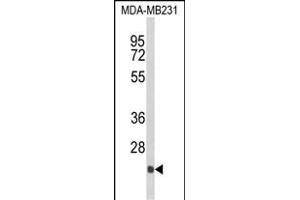 Western blot analysis of DERL2 Antibody (C-term) (ABIN652652 and ABIN2842438) in MDA-M cell line lysates (35 μg/lane). (Der1-Like Domain Family, Member 2 (DERL2) (AA 191-218), (C-Term) Antikörper)