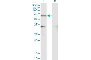 Western Blotting (WB) image for anti-Nuclear Receptor Subfamily 4, Group A, Member 2 (NR4A2) (AA 71-170) antibody (ABIN518477)