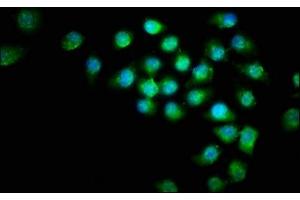 Immunofluorescence staining of A549 cells with ABIN7145207 at 1:266, counter-stained with DAPI. (Survivin Antikörper  (AA 1-130))