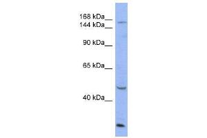 WB Suggested Anti-ATP7A  Antibody Titration: 0. (ATP7A Antikörper  (Middle Region))