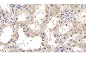 Detection of PARK7 in Human Kidney Tissue using Monoclonal Antibody to Parkinson Disease Protein 7 (PARK7) (PARK7/DJ1 Antikörper  (AA 2-189))