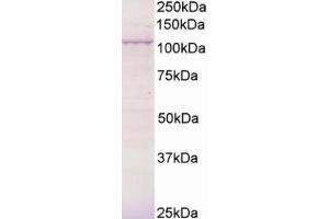 Western Blotting (WB) image for anti-Breast Cancer Anti-Estrogen Resistance 3 (BCAR3) (C-Term) antibody (ABIN2465465) (BCAR3 Antikörper  (C-Term))