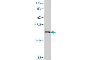 Western Blot detection against Immunogen (37. (SMC1A Antikörper  (AA 366-465))