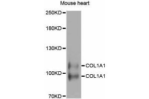 Western blot analysis of extracts of mouse heart, using COL1A1 antibody (ABIN5997480) at 1/1000 dilution. (COL1A1 Antikörper)