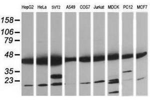 Image no. 8 for anti-Mitogen-Activated Protein Kinase Kinase 1 (MAP2K1) antibody (ABIN1499385) (MEK1 Antikörper)