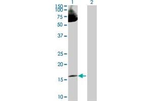 Lane 1: LMO2 transfected lysate ( 18. (LMO2 293T Cell Transient Overexpression Lysate(Denatured))