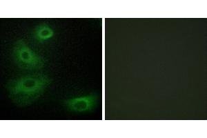 Peptide - +Immunohistochemistry analysis of paraffin-embedded human brain tissue, using 5-HT-1B antibody. (5HT1B Receptor Antikörper  (Internal Region))