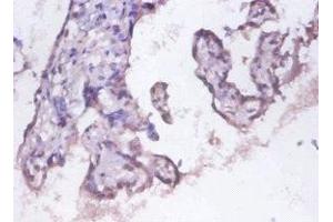 Immunohistochemistry of paraffin-embedded human placenta tissue using ABIN7142202 at dilution of 1:100 (PSMD11 Antikörper  (Regulatory Subunit 11))