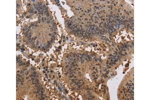 Immunohistochemistry (IHC) image for anti-Jagged 2 (JAG2) antibody (ABIN2434862) (JAG2 Antikörper)