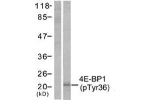 Western Blotting (WB) image for anti-Eukaryotic Translation Initiation Factor 4E Binding Protein 1 (EIF4EBP1) (pThr36) antibody (ABIN2888349) (eIF4EBP1 Antikörper  (pThr36))