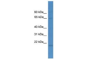 WB Suggested Anti-LTA4H Antibody Titration: 0. (LTA4H Antikörper  (N-Term))