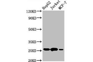 Western Blotting (WB) image for anti-B-Cell CLL/lymphoma 2 (BCL2) antibody (ABIN7127273)