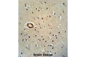 Immunohistochemistry (IHC) image for anti-CWC22 Spliceosome-Associated Protein Homolog (CWC22) antibody (ABIN2995841) (CWC22 Antikörper)