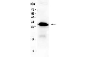 Western blot analysis of IGFBP1 using anti-IGFBP1 antibody . (IGFBPI Antikörper  (AA 69-259))