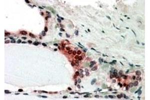 Immunohistochemistry (IHC) image for anti-Casein beta (CSN2) antibody (ABIN5859099) (CSN2 Antikörper)