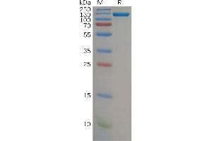 Complement Factor B Protein (CFB) (AA 26-764) (Fc Tag)