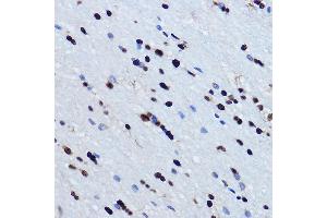 Immunohistochemistry of paraffin-embedded mouse brain using TDP-43/TARDB Rabbit pAb  at dilution of 1:500 (40x lens). (TARDBP Antikörper  (AA 1-100))