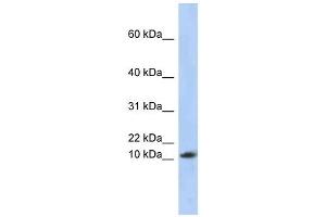 RPL30 antibody used at 1 ug/ml to detect target protein. (RPL30 Antikörper  (Middle Region))