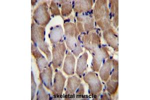 Immunohistochemistry (IHC) image for anti-Selenoprotein N, 1 (SEPN1) antibody (ABIN2996755) (SEPN1 Antikörper)