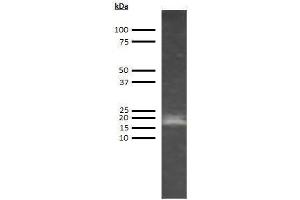 Western Blotting (WB) image for anti-Adiponectin (ADIPOQ) antibody (ABIN613395) (ADIPOQ Antikörper)