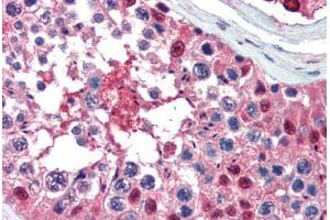 Human Testis (formalin-fixed, paraffin-embedded) stained with Ubiquitin antibody ABIN462097 at 10 ug/ml followed by biotinylated goat anti-rabbit IgG secondary antibody ABIN481713, alkaline phosphatase-streptavidin and chromogen. (Ubiquitin Antikörper)