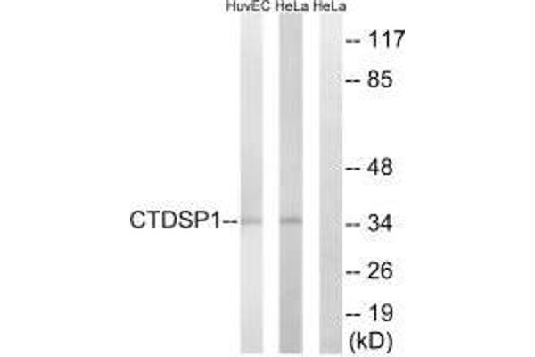 CTDSP1 Antikörper  (N-Term)
