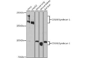 Western blot analysis of extracts of various cell lines, using Syndecan 1 Rabbit mAb (ABIN1683195, ABIN3018651, ABIN3018652 and ABIN7101639) at 1:1000 dilution. (Syndecan 1 Antikörper)