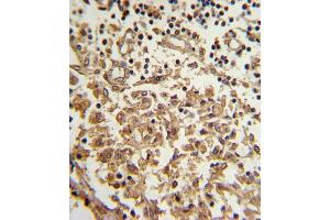 Immunohistochemistry (IHC) image for anti-Telomerase Reverse Transcriptase (TERT) antibody (ABIN2997736) (TERT Antikörper)