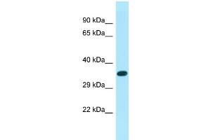 Western Blotting (WB) image for anti-XK, Kell Blood Group Complex Subunit-Related Family, Member 6 (XKR6) (C-Term) antibody (ABIN2790601) (XKR6 Antikörper  (C-Term))