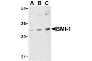 Image no. 1 for anti-BMI1 Polycomb Ring Finger Oncogene (BMI1) (Internal Region) antibody (ABIN200102) (BMI1 Antikörper  (Internal Region))
