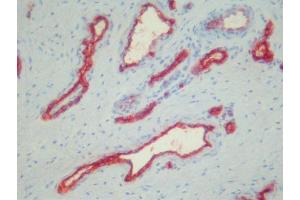 Immunohistochemistry (IHC) image for anti-Platelets antibody (ABIN781797) (Platelets Antikörper)