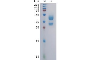 Human C Protein, mFc Tag on SDS-PAGE under reducing condition. (CXCR3 Protein (AA 1-53) (mFc Tag))