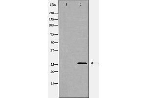 Western blot analysis of extracts of  hela , using LGALS3 antibody. (Galectin 3 Antikörper  (Internal Region))