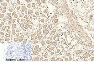 Immunohistochemical analysis of paraffin-embedded human stomach tissue. (CD4 Antikörper)