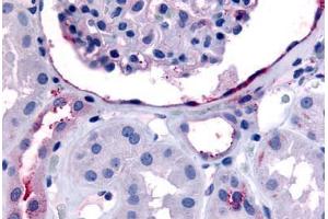 Human Glomerulus and Renal Tubular Epithelium in Cortex (formalin-fixed, paraffin-embedded) stained with ERBB4 antibody ABIN213439 at 30-60 ug/ml followed by biotinylated goat anti-rabbit IgG secondary antibody ABIN481713, alkaline phosphatase-streptavidin  . (ERBB4 Antikörper  (C-Term))