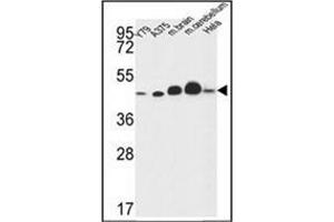 Western blot analysis of NDUFS2 Antibody (Center) in Y79,A375,Hela cell line and mouse brain,cerebellum tissue lysates (35ug/lane). (NDUFS2 Antikörper  (Middle Region))