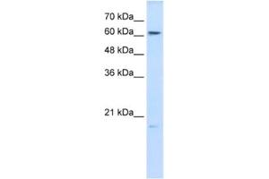 Western Blotting (WB) image for anti-Glutathione Peroxidase 3 (Plasma) (GPX3) antibody (ABIN2462422) (GPX3 Antikörper)